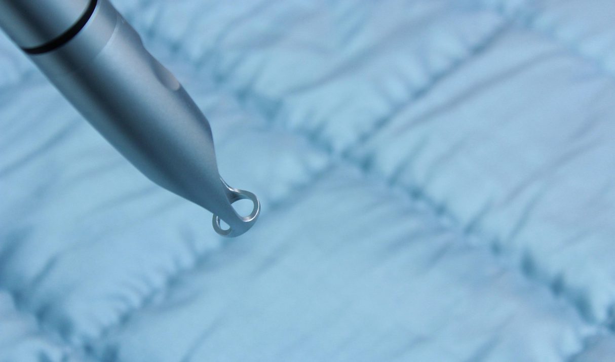 De voordelen van laser ontharen voor een langdurig resultaat